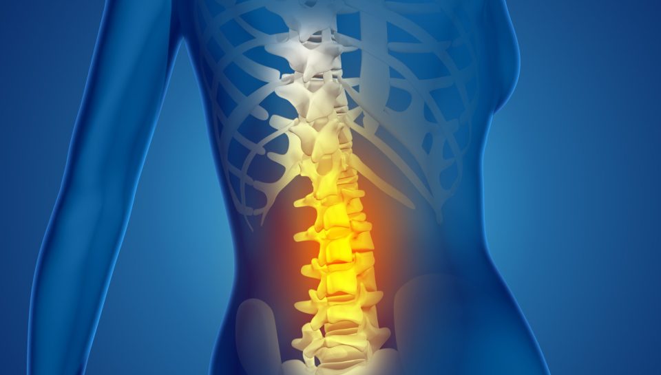 3D render of a female medical figure with spine highlighted