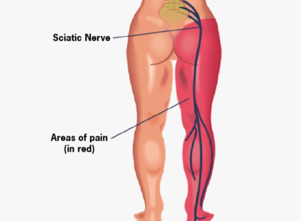 860b7d_cc762a3a8ac6439aa6b3947e391abc6a~mv2