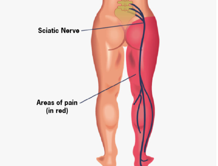 860b7d_cc762a3a8ac6439aa6b3947e391abc6a~mv2